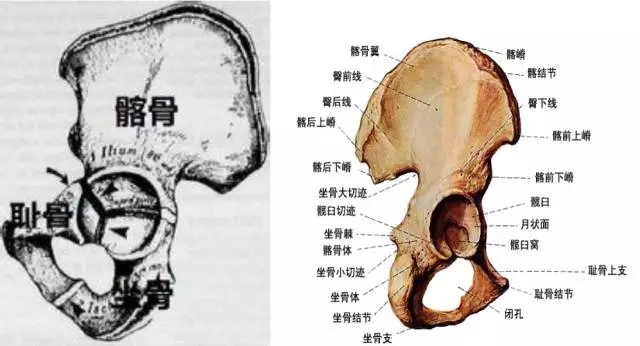 髋臼四边体图片