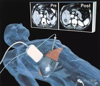 图片9.jpg 图片9.jpg